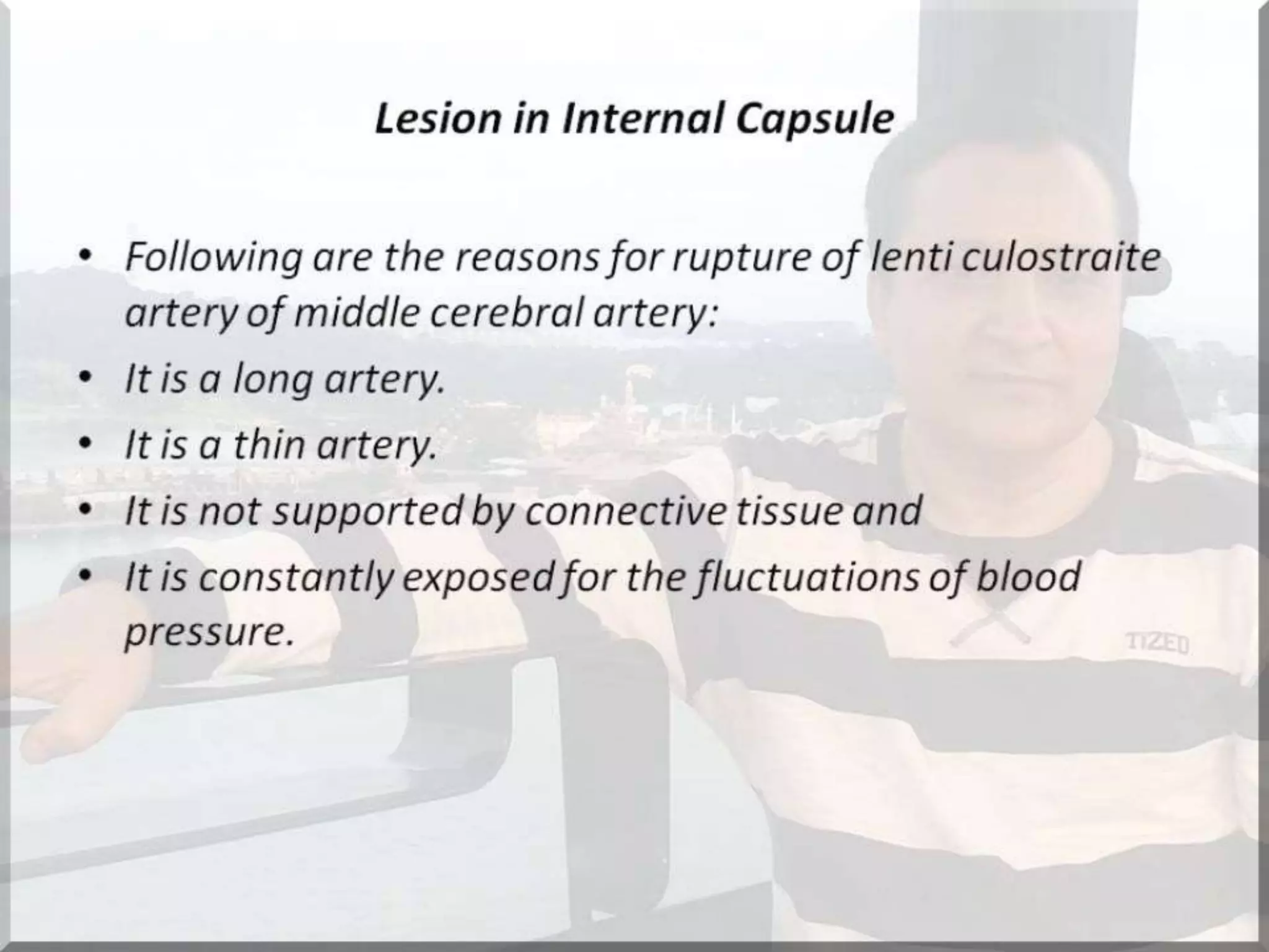 Localization of brainstem lesion by Prof Dr Bashir Ahmed Dar Sopore Kashmir