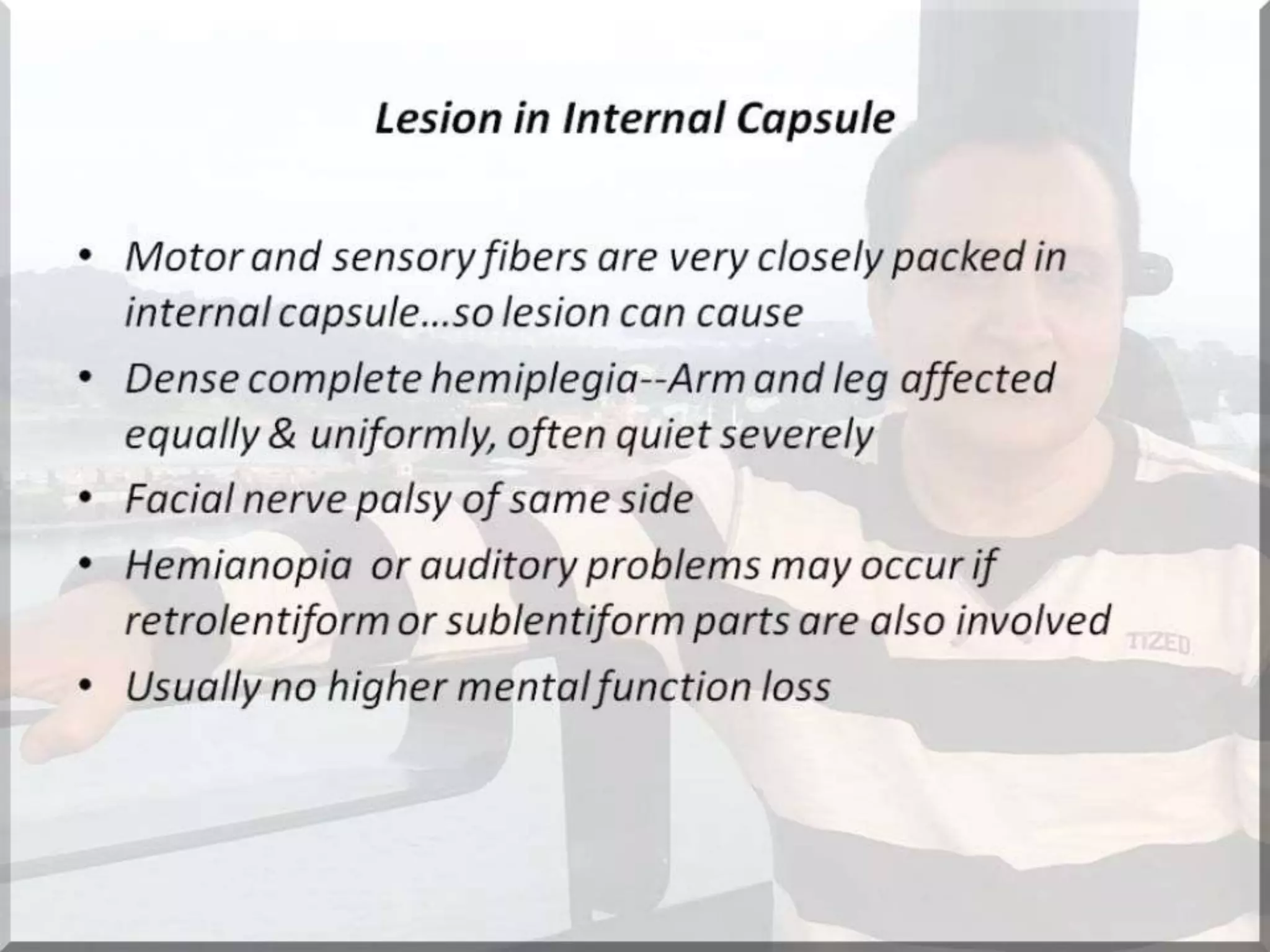 Localization of brainstem lesion by Prof Dr Bashir Ahmed Dar Sopore Kashmir