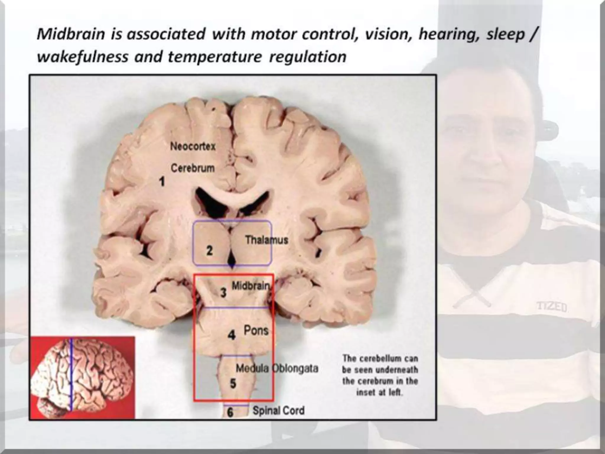 Localization of brainstem lesion by Prof Dr Bashir Ahmed Dar Sopore Kashmir