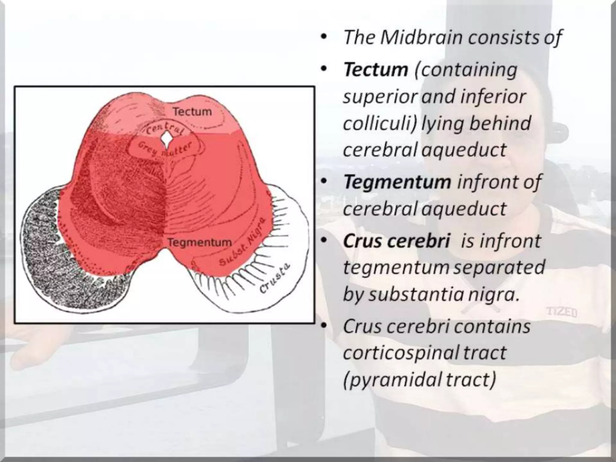 Localization of brainstem lesion by Prof Dr Bashir Ahmed Dar Sopore Kashmir