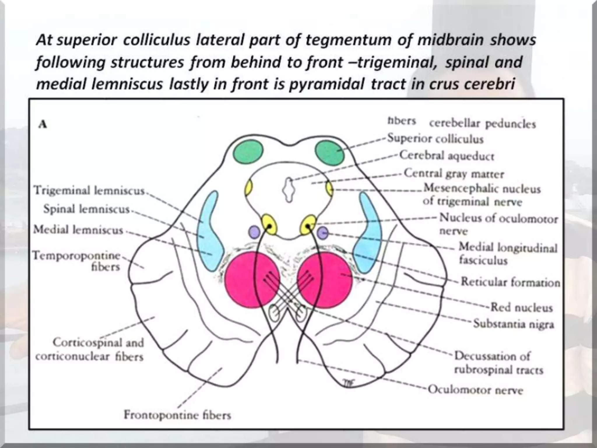 Localization of brainstem lesion by Prof Dr Bashir Ahmed Dar Sopore Kashmir