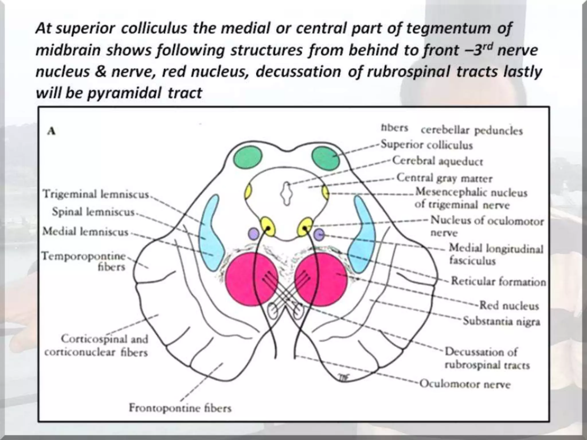 Localization of brainstem lesion by Prof Dr Bashir Ahmed Dar Sopore Kashmir