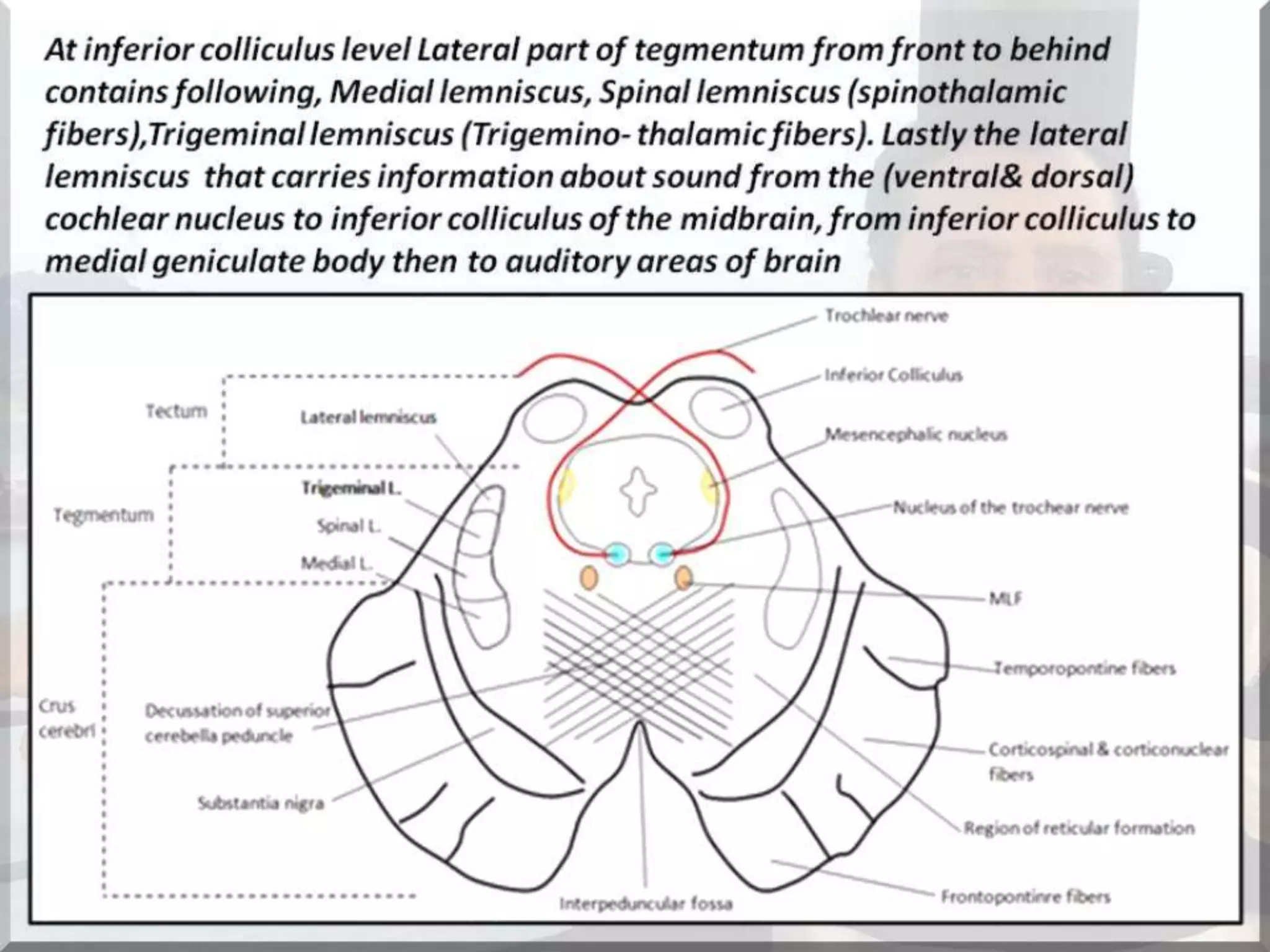 Localization of brainstem lesion by Prof Dr Bashir Ahmed Dar Sopore Kashmir