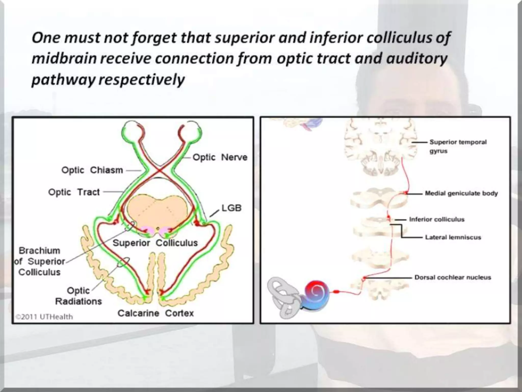 Localization of brainstem lesion by Prof Dr Bashir Ahmed Dar Sopore Kashmir