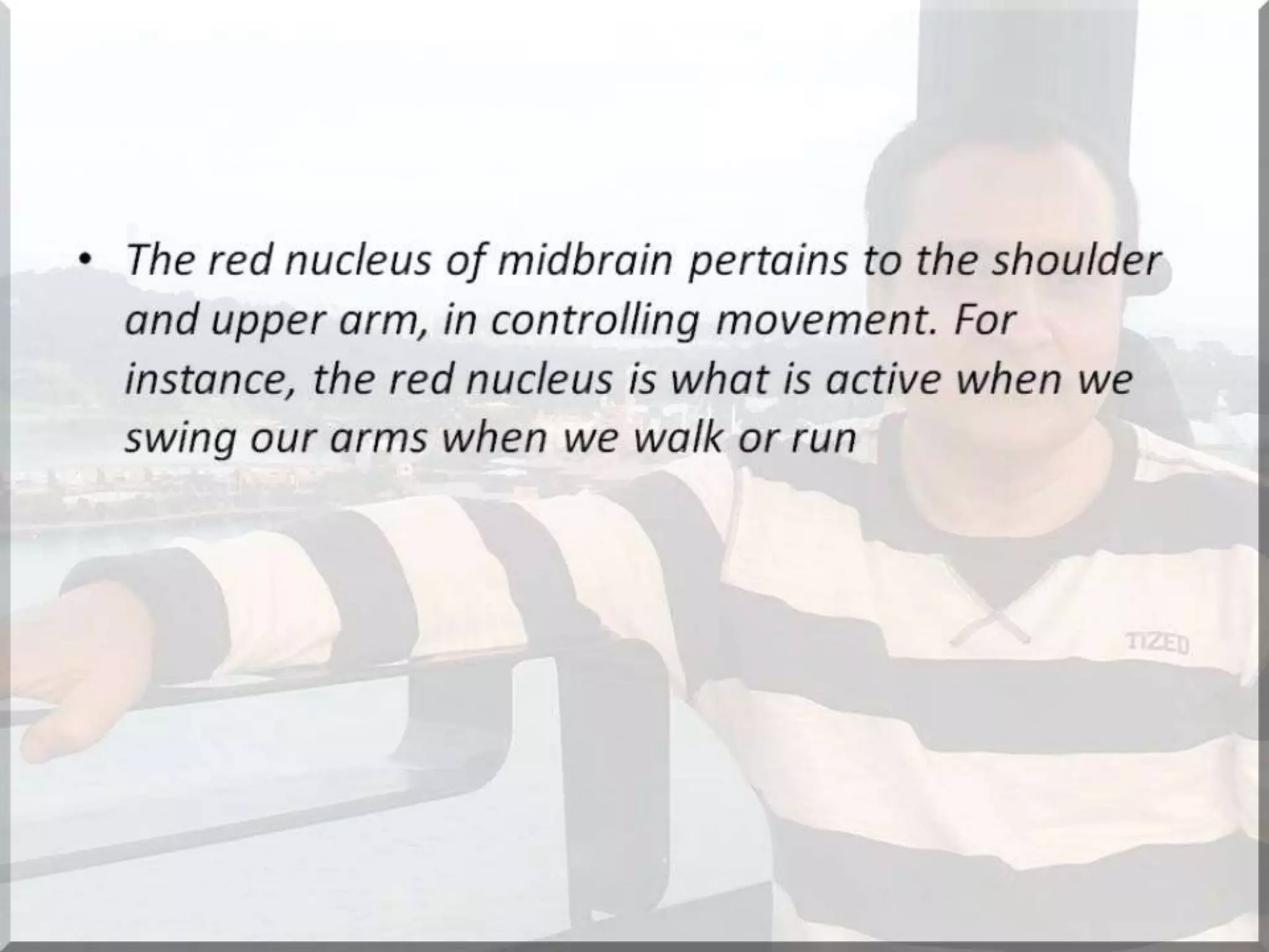 Localization of brainstem lesion by Prof Dr Bashir Ahmed Dar Sopore Kashmir