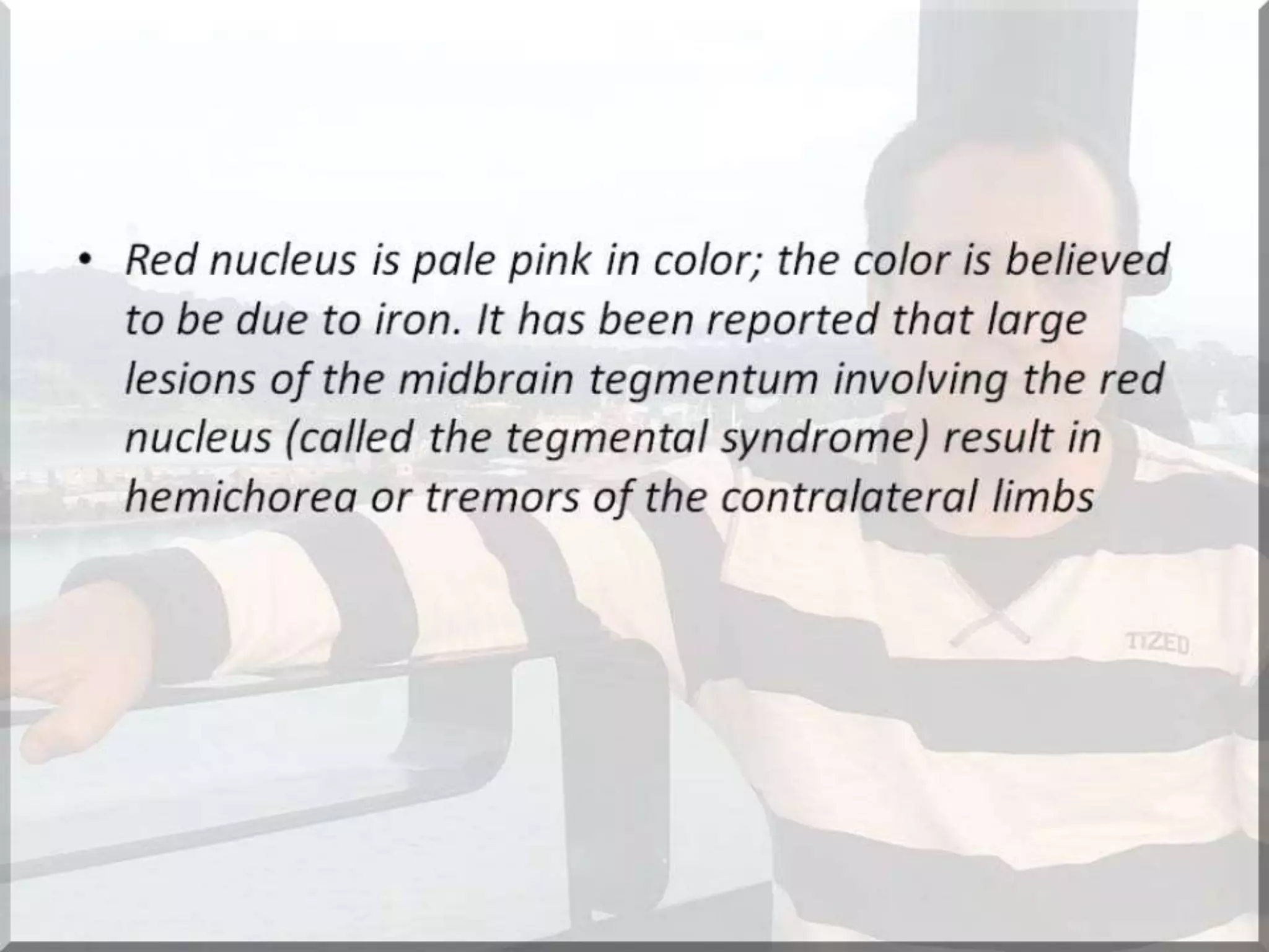 Localization of brainstem lesion by Prof Dr Bashir Ahmed Dar Sopore Kashmir