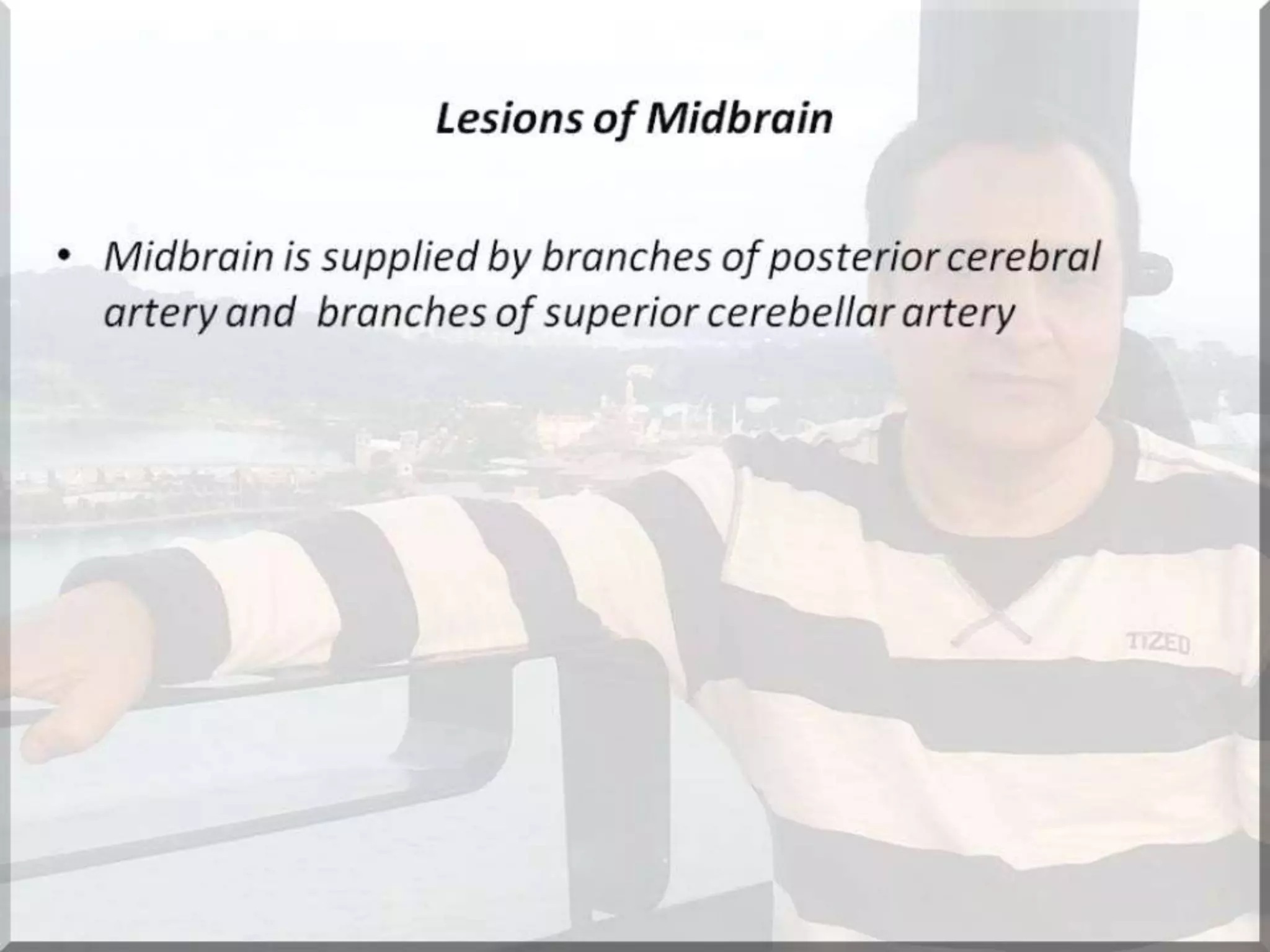 Localization of brainstem lesion by Prof Dr Bashir Ahmed Dar Sopore Kashmir