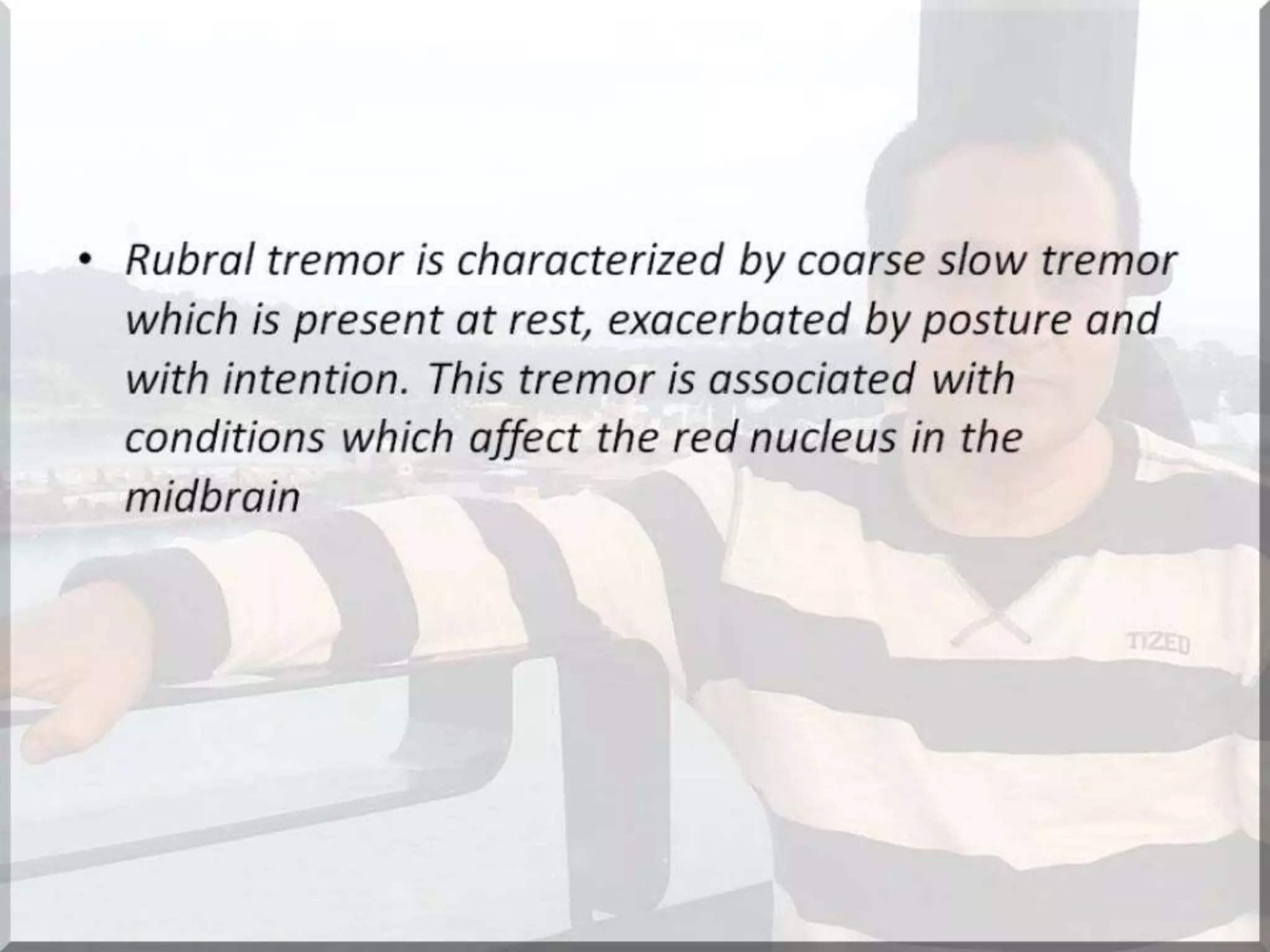 Localization of brainstem lesion by Prof Dr Bashir Ahmed Dar Sopore Kashmir