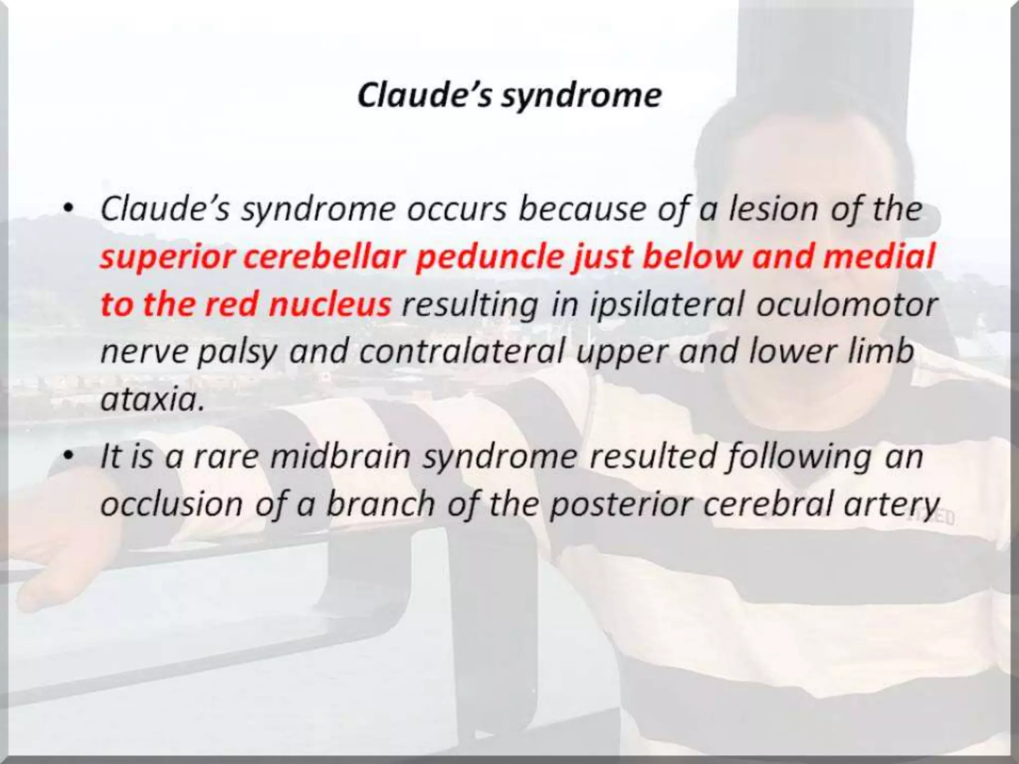Localization of brainstem lesion by Prof Dr Bashir Ahmed Dar Sopore Kashmir