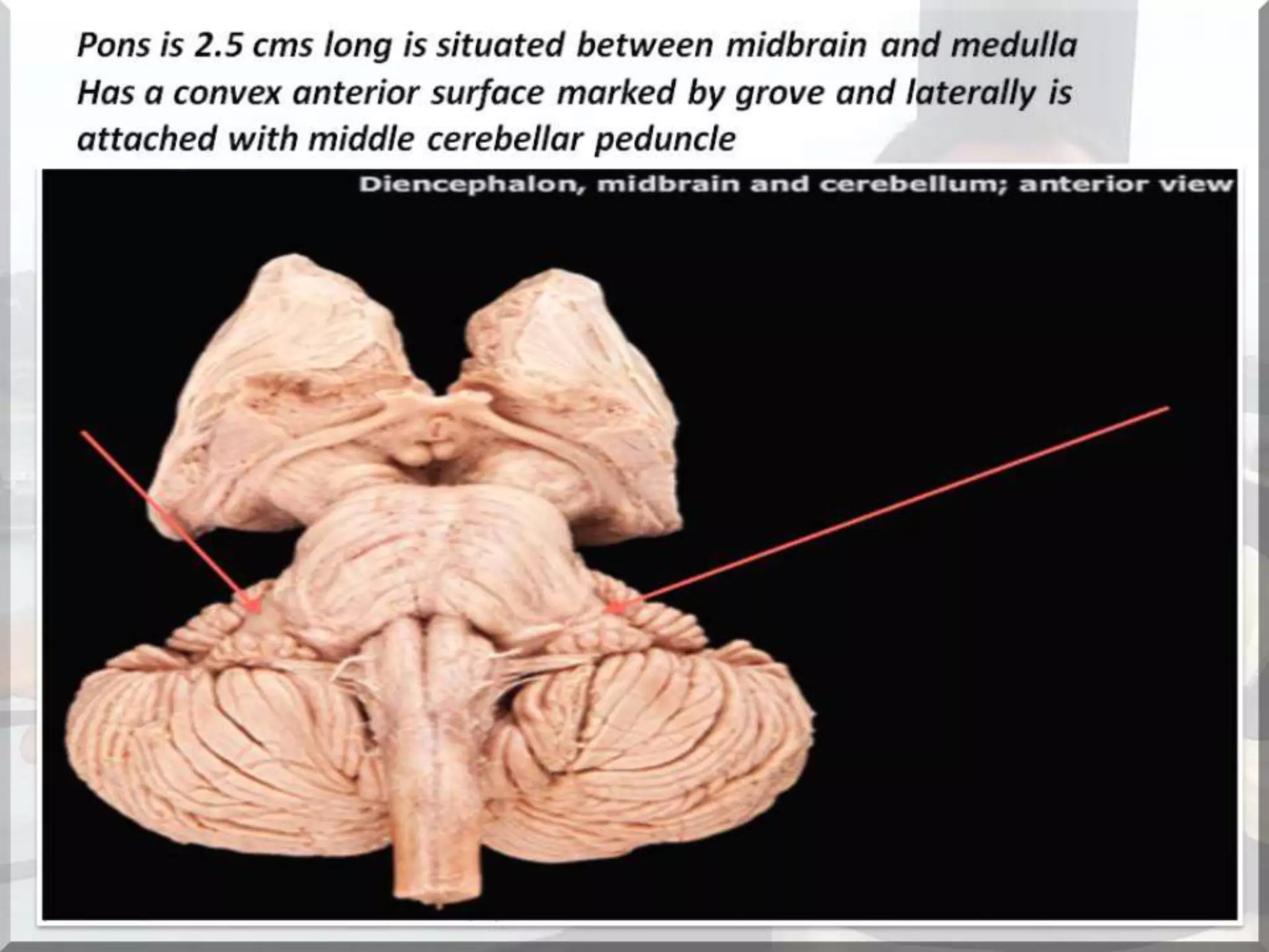 Localization of brainstem lesion by Prof Dr Bashir Ahmed Dar Sopore Kashmir