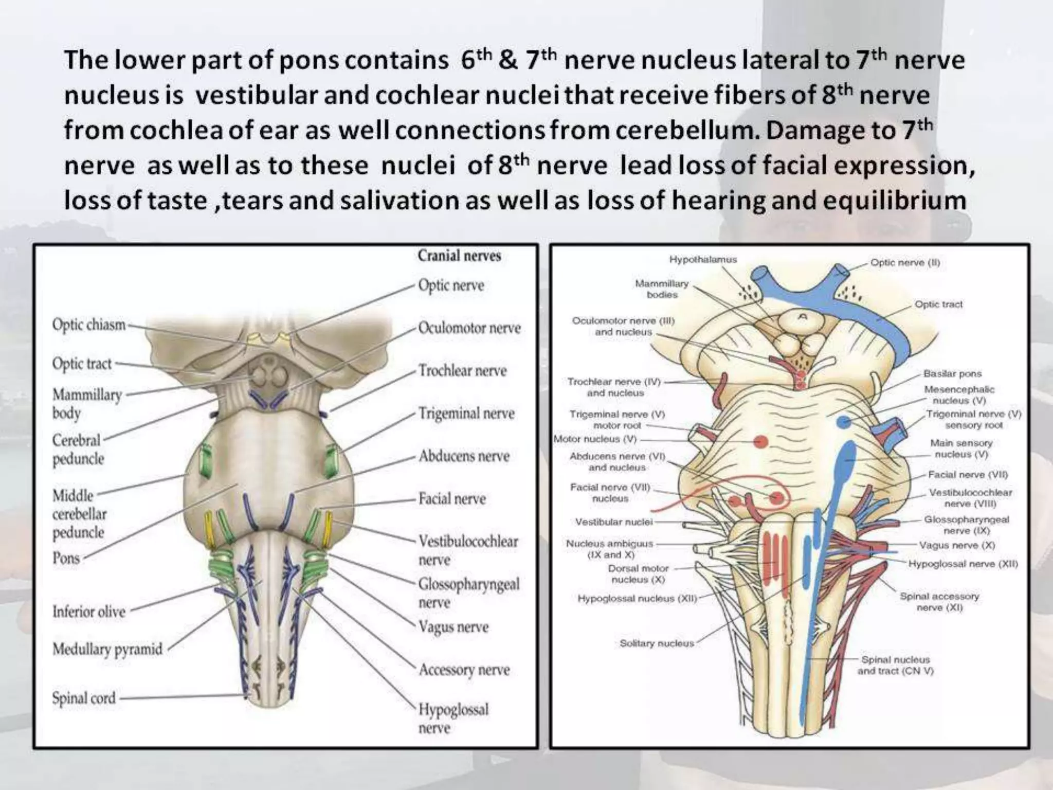 Localization of brainstem lesion by Prof Dr Bashir Ahmed Dar Sopore Kashmir
