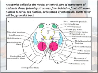 Localization of brainstem lesion by Prof Dr Bashir Ahmed Dar Sopore ...