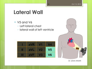 Lateral Wall <ul><li>V5 and V6 </li></ul><ul><ul><li>Left lateral chest </li></ul></ul><ul><ul><li>lateral wall of left ve...