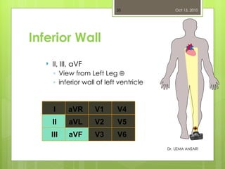 Dr. UZMA ANSARI Inferior Wall <ul><li>II, III, aVF </li></ul><ul><ul><li>View from Left Leg   </li></ul></ul><ul><ul><li>...