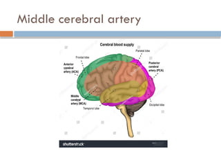 Midbrain Infarct Localization Localization of stroke powerpoint presentation | PPTX