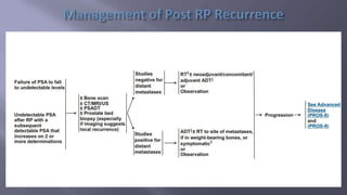 Locally Advanced Carcinoma Prostate
