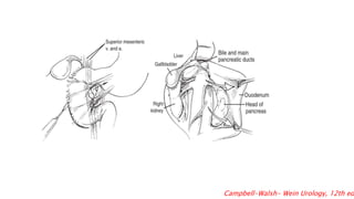 Locally advanced renal cell carcinoma RCC | PPTX