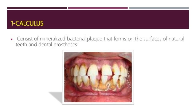 local predisposing factor of periodontal disease how does plaque form