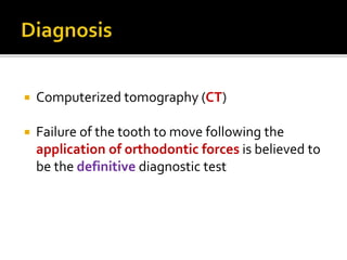  Computerized tomography (CT)
 Failure of the tooth to move following the
application of orthodontic forces is believed to
be the definitive diagnostic test
 