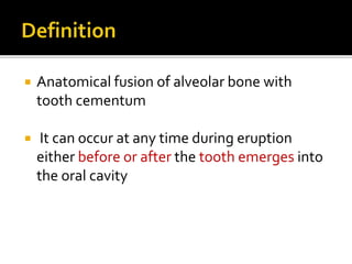  Anatomical fusion of alveolar bone with
tooth cementum
 It can occur at any time during eruption
either before or after the tooth emerges into
the oral cavity
 