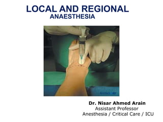 Dr. Nisar Ahmed Arain
Assistant Professor
Anesthesia / Critical Care / ICU
LOCAL AND REGIONAL
ANAESTHESIA
 