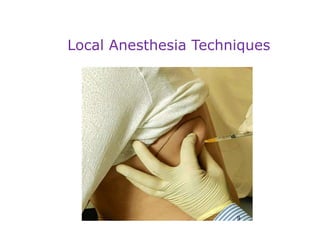9
Local Anesthesia Techniques
 