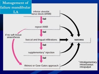 Management of
failure mandibular
LA

 