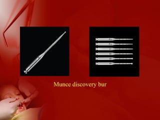 Munce discovery bur
 