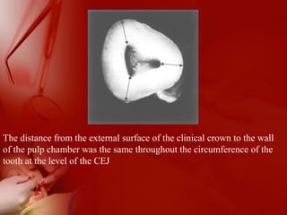 The distance from the external surface of the clinical crown to the wall
of the pulp chamber was the same throughout the circumference of the
tooth at the level of the CEJ
a
 