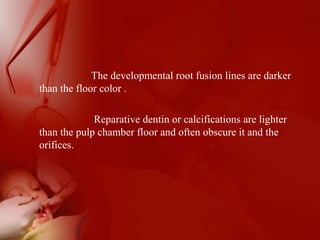 The developmental root fusion lines are darker
than the floor color .
Reparative dentin or calcifications are lighter
than the pulp chamber floor and often obscure it and the
orifices.
 