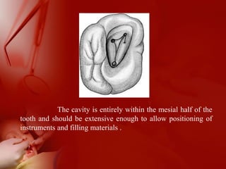 The cavity is entirely within the mesial half of the
tooth and should be extensive enough to allow positioning of
instruments and filling materials .
 