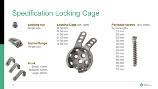 Specification Locking Cage
16
Locking nut
Single size
Ischial flange
Single size
Hook
Small: 10mm
Medium: 15mm
Large: 20mm
Locking Cage (left, right)
Φ 50 mm
Φ 54 mm
Φ 58 mm
Φ 62 mm
Φ 66 mm
Φ 70 mm
Polyaxial screws (Φ 6.5mm)
Screw lengths:
15 mm
20 mm
25 mm
30 mm
35 mm
40 mm
45 mm
50 mm
55 mm
60 mm
65 mm
70 mm
75 mm
 