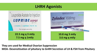 LHRH Agonists
22.5 mg q 3 mtly
7.5 mg q 1mtly
10.8 mg 3 mtly
3.6 mg q mtly
They are used for Medical Ovarian Suppression
MOA- Desensitisation of pituitary to GnRH Secretion of LH & FSH from Pituitary
 