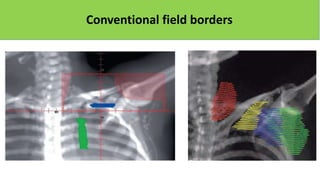 Conventional field borders
 