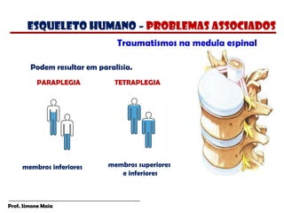 Prof. Simone Maia
Podem resultar em paralisia.
TETRAPLEGIA
PARAPLEGIA
Traumatismos na medula espinal
membros inferiores membros superiores
e inferiores
esqueleto humano – PROBLEMAS ASSOCIADOS
 