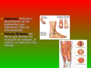 • Esguinces: Roturas o
    distensiones de los
    ligamentos que
    mantienen fijas las
    articulaciones.
•   Roturas fibrilares: las
    fibras que forman los
    músculos se rompen, al
    realizar un ejercicio muy
    intenso.
 