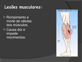 Lesões musculares: Rompimento e morte de células dos músculos. Causa dor e impede movimentos. 
