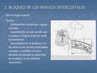 3. BLOQUEO DE LOS NERVIOS INTERCOSTALES
 Técnica:
 Emplearemos una jeringa y agujas
normales
 Generalmente es más sencillo que
lo realiza el cirujano antes de cerrar
la toracotomía
 Administraremos el anestésico en
las raíces de los nervios intercostales
craneales y caudales a la zona
afectada (dividiremos la dosis total
de anestésico en las distintas
inyecciones).
 Útil en cirugía torácica
 