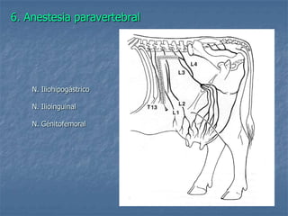 6. Anestesia paravertebral
N. Iliohipogástrico
N. Ilioinguinal
N. Génitofemoral
 