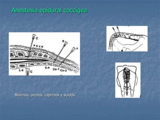 Anestesia epidural coccígea
Bovinos, ovinos, caprinos y suidos
 