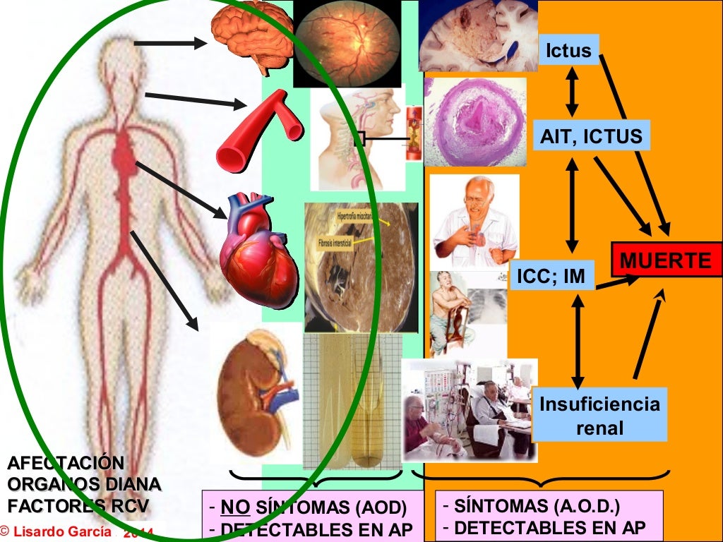 Lesión de Organos diana en la HTA. Como detectarlas desde la Atención… Lesión de Organos diana en la HTA. Como detectarlas desde la Atención…