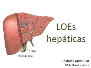 LOEs
hepáticas
Cristina Conde Díaz
R2 de Medicina Interna
 