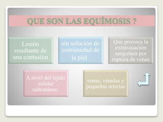 QUE SON LAS EQUÍMOSIS ?
Lesión
resultante de
una contusión
sin solución de
continuidad de
la piel
Que provoca la
extravasación
sanguínea por
ruptura de venas
venas, vénulas y
pequeñas arterias
A nivel del tejido
celular
subcutáneo.
 