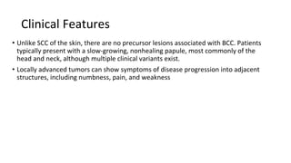 NON MELANOMA AND MELANOMA SKIN MALIGNANCIES NMSC HN REGION | PPTX