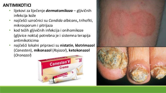 Lokalno liječenje dermatoza