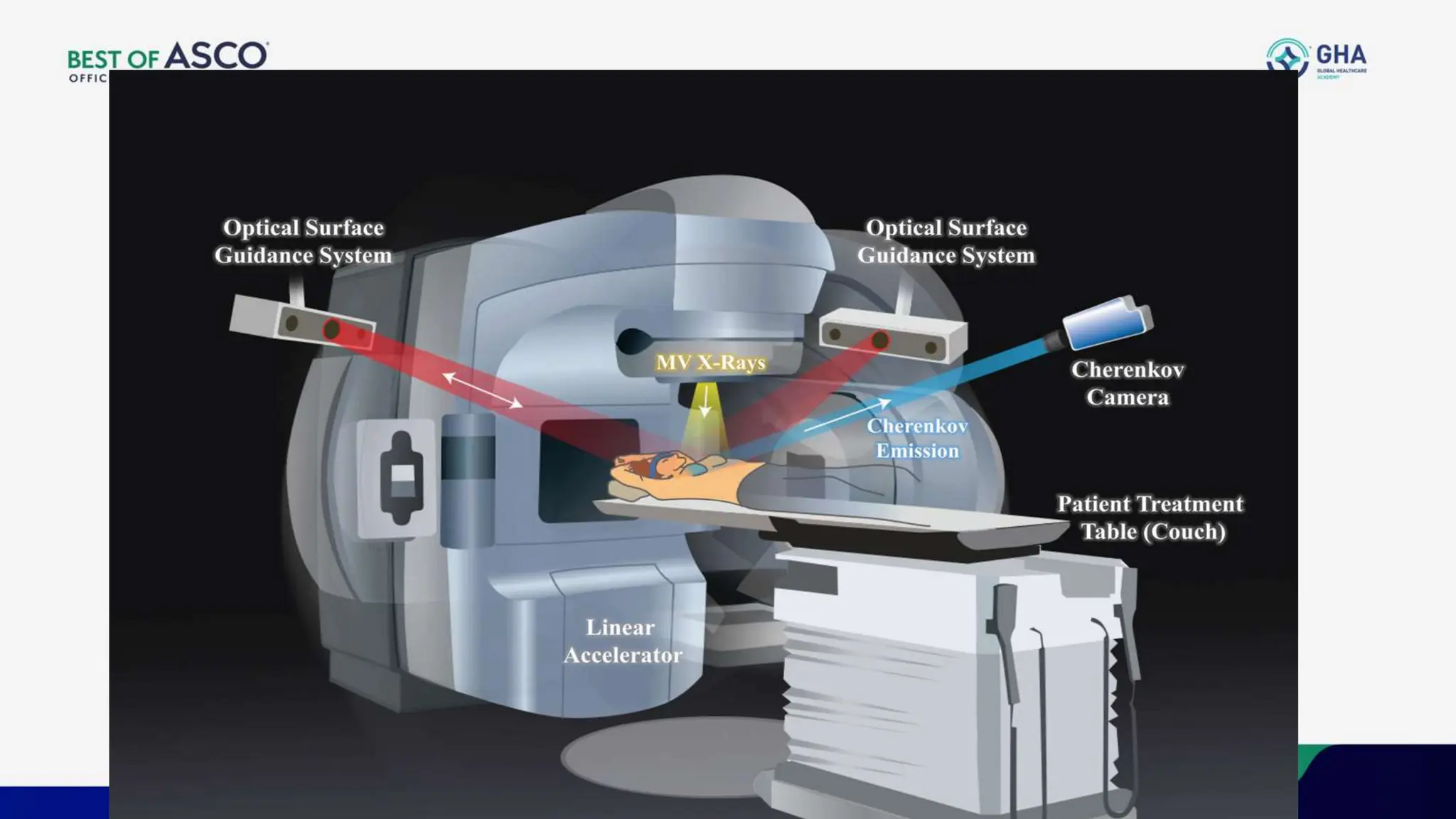 AI & Recent Advances in Radiation Oncology 2024 | PPTX