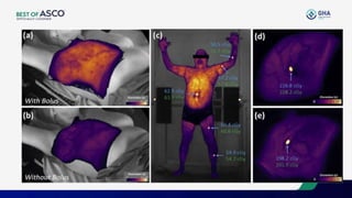AI & Recent Advances in Radiation Oncology 2024 | PPTX