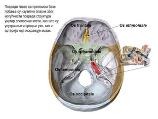 Os frontale
Os occipitale
Os sphenoidale
Os ethmoidale
Os temporale
Повреде главе са преломом базе
лобање су изузетно опасне због
могућности повреда структура
унутар слепоочне кости, као што су
унутрашње и средње ухо, као и
артерија која исхрањује мозак.
 