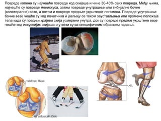 Повреде колена су најчешће повреде код скијаша и чине 30-40% свих повреда. Међу њима,
најчешће су повреде менискуса, затим повреде унутрашње или тибијалне бочне
(колатералне) везе, а потом и повреде предњег укрштеног лигамена. Повреде унутрашње
бочне везе чешће су код почетника и јављају се током заустављања или промене положаја
тела када су предњи крајеви скија усмерени унутра, док су повреде предње укрштене везе
чешће код искуснијих скијаша и у вези су са специфичним обрасцем падања.
lig. collaterale tibiale
lig. collaterale tibiale
 