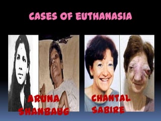 Cases of euthanasia




 Aruna      Chantal
Shanbaug    Sabire
 